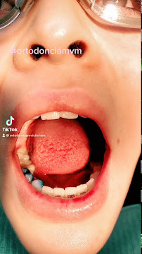 Ortodoncia MVM - Medicina Dental - Ortodoncia - Diseño de sonrisa - Alineadores