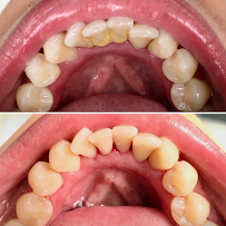 Ortodoncia MVM - Medicina Dental - Ortodoncia - Diseño de sonrisa - Alineadores