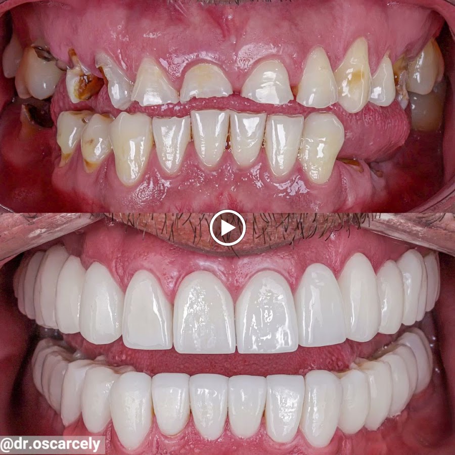 Unidad Robótica Dental by Dr.Oscar Cely - dental clinic in Bogota, Colombia