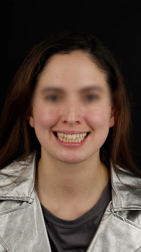 Unidad Robótica Dental by Dr.Oscar Cely
