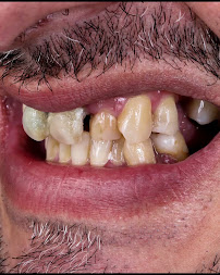 Unidad Robótica Dental by Dr.Oscar Cely