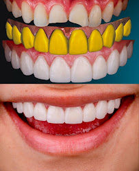 Unidad Robótica Dental by Dr.Oscar Cely