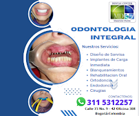Dental Center MD Mauricio Duran Implantes y Diseño de Sonrisa