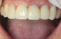 Dr Carlos Castro Rehabilitador Oral Bogotá Implantes dentales