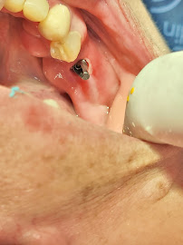 Dr Carlos Castro Rehabilitador Oral Bogotá Implantes dentales