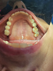 Dr Carlos Castro Rehabilitador Oral Bogotá Implantes dentales