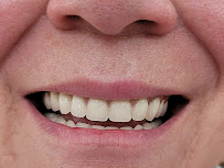 Dr Carlos Castro Rehabilitador Oral Bogotá Implantes dentales