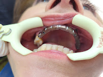 Dr Carlos Castro Rehabilitador Oral Bogotá Implantes dentales