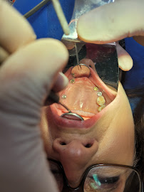 Dr Carlos Castro Rehabilitador Oral Bogotá Implantes dentales