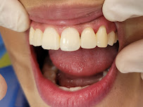 Dr Carlos Castro Rehabilitador Oral Bogotá Implantes dentales