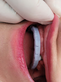 Dr Carlos Castro Rehabilitador Oral Bogotá Implantes dentales