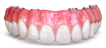 Prof. Dr. Carlos Garcés Dental Implant Center