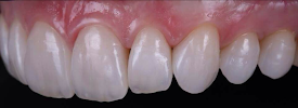 Prof. Dr. Carlos Garcés Dental Implant Center