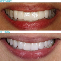 Prof. Dr. Carlos Garcés Dental Implant Center