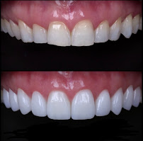 Prof. Dr. Carlos Garcés Dental Implant Center