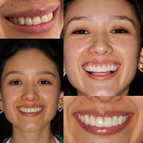 Dr. Catalina Ramirez | Cosmetic Dentist