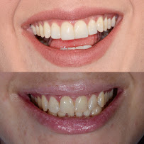 Dr. Catalina Ramirez | Cosmetic Dentist
