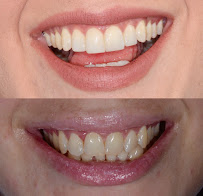 Dr. Catalina Ramirez | Cosmetic Dentist