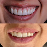 Dr. Catalina Ramirez | Cosmetic Dentist