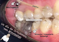 Dental VIP Service - Dra Patrícia Valenzuela Peña