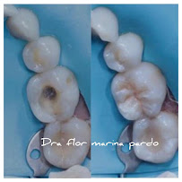 Oficina Dental Especializada - Dra. Flor Marina Pardo