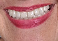 Clínica Dentistas por Chile