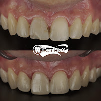Clínica Dental Dentalex