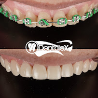 Clínica Dental Dentalex