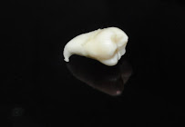 CLINICA DENTELITE Implantes Dentales Dentistas en Providencia Santiago