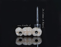 CLINICA DENTELITE Implantes Dentales Dentistas en Providencia Santiago