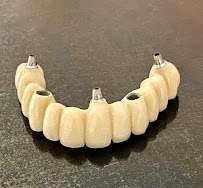 CLINICA DENTELITE Implantes Dentales Dentistas en Providencia Santiago