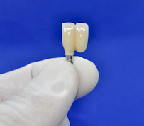 CLINICA DENTELITE Implantes Dentales Dentistas en Providencia Santiago