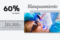 CLINICA DENTELITE Implantes Dentales Dentistas en Providencia Santiago