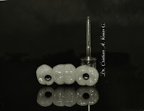 CLINICA DENTELITE Implantes Dentales Dentistas en Providencia Santiago