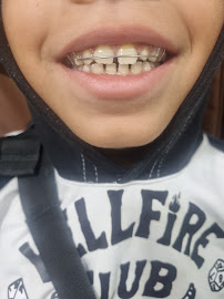 Universo Dentistas | Urgencias Odontológicas | Dentista en Santiago