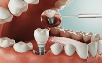 Clínica Dental DIVEDENT
