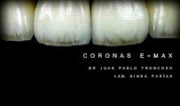 Oh My Dent! - Clínica Dental en Viña del Mar