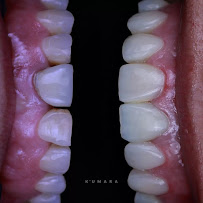 Oh My Dent! - Clínica Dental en Viña del Mar