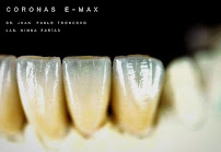 Oh My Dent! - Clínica Dental en Viña del Mar