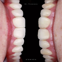 Oh My Dent! - Clínica Dental en Viña del Mar