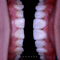 Oh My Dent! - Clínica Dental en Viña del Mar