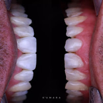 Oh My Dent! - Clínica Dental en Viña del Mar