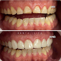 Clínica Dentalife l Dentista Viña del Mar