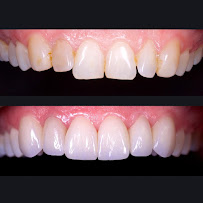 Clínica dental Viña del mar: Dr. Javier González