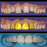 Clínica dental Viña del mar: Dr. Javier González