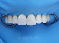 Clínica dental Viña del mar: Dr. Javier González