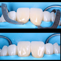 Clínica dental Viña del mar: Dr. Javier González