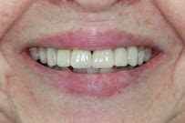 Clínica dental Viña del mar: Dr. Javier González