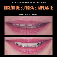 Clínica dental Viña del mar: Dr. Javier González
