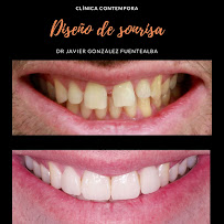 Clínica dental Viña del mar: Dr. Javier González